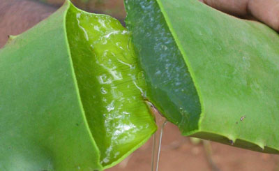 Gel de aloe vera