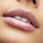 Queiloplastia: Cirugía de labios